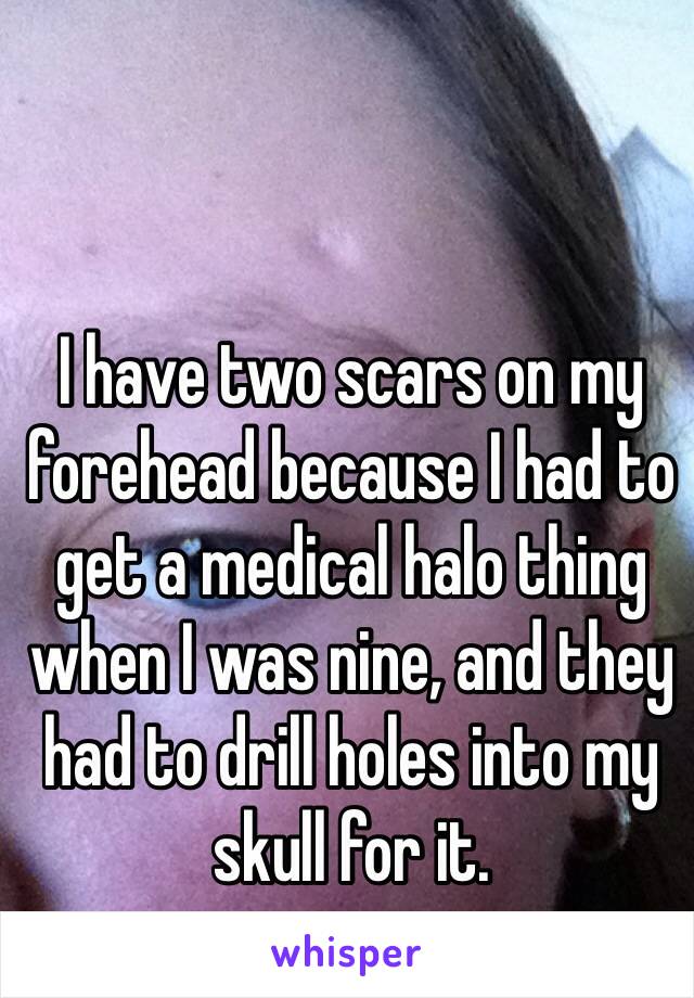 I have two scars on my forehead because I had to get a medical halo thing when I was nine, and they had to drill holes into my skull for it.