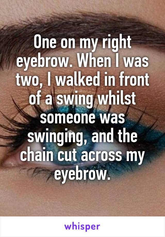 One on my right eyebrow. When I was two, I walked in front of a swing whilst someone was swinging, and the chain cut across my eyebrow.
