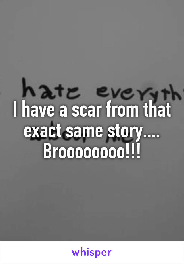 I have a scar from that exact same story.... Broooooooo!!!