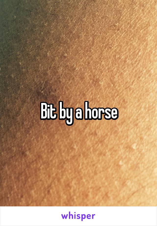 Bit by a horse