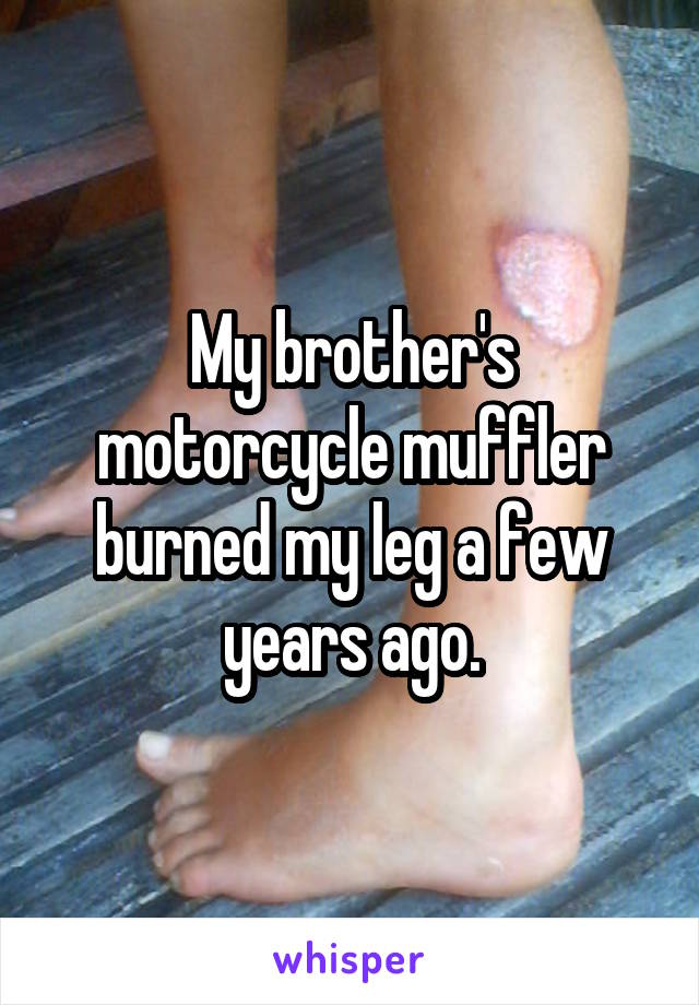 My brother's motorcycle muffler burned my leg a few years ago.