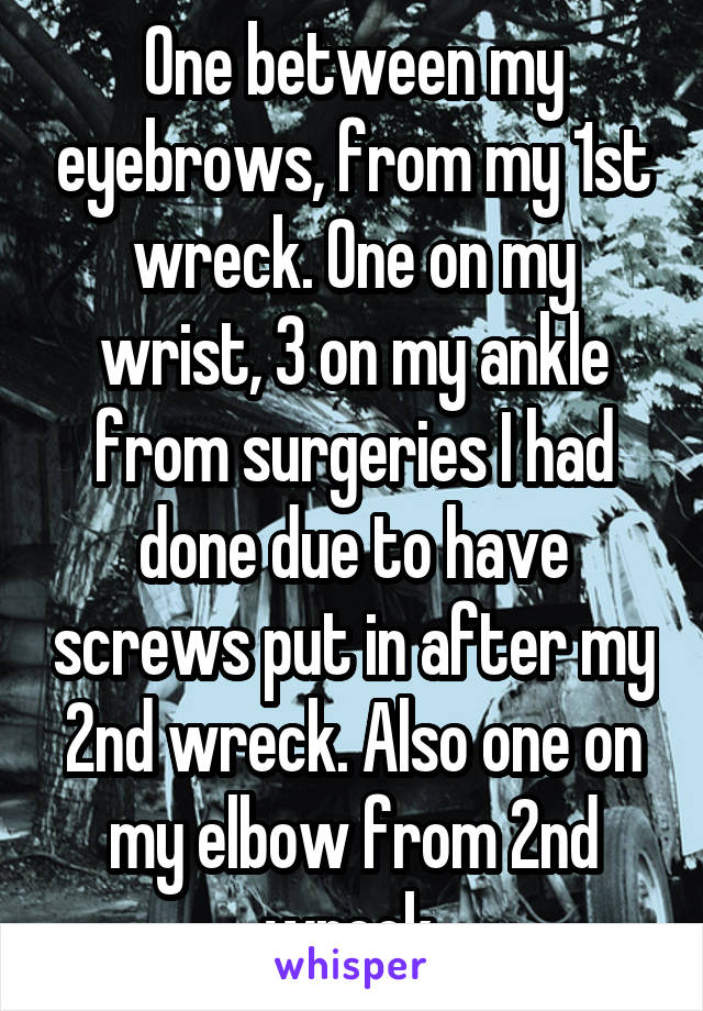 One between my eyebrows, from my 1st wreck. One on my wrist, 3 on my ankle from surgeries I had done due to have screws put in after my 2nd wreck. Also one on my elbow from 2nd wreck.