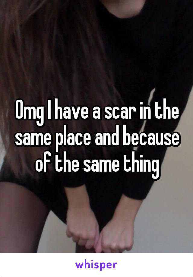 Omg I have a scar in the same place and because of the same thing