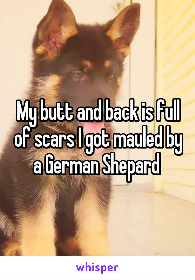 My butt and back is full of scars I got mauled by a German Shepard 