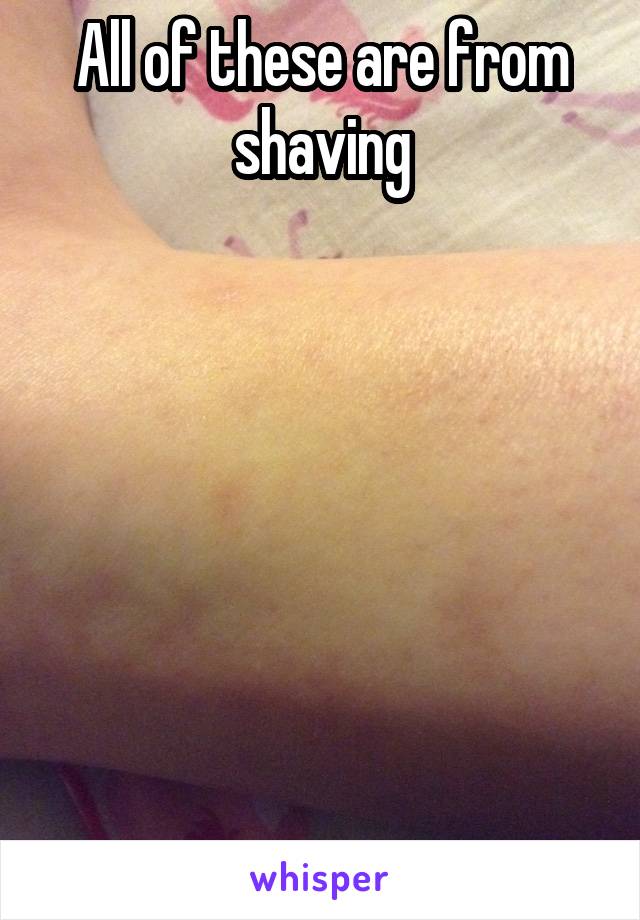 All of these are from shaving







