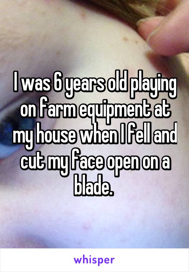 I was 6 years old playing on farm equipment at my house when I fell and cut my face open on a blade. 