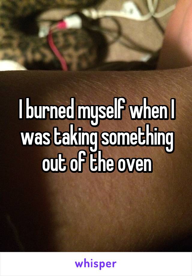 I burned myself when I was taking something out of the oven