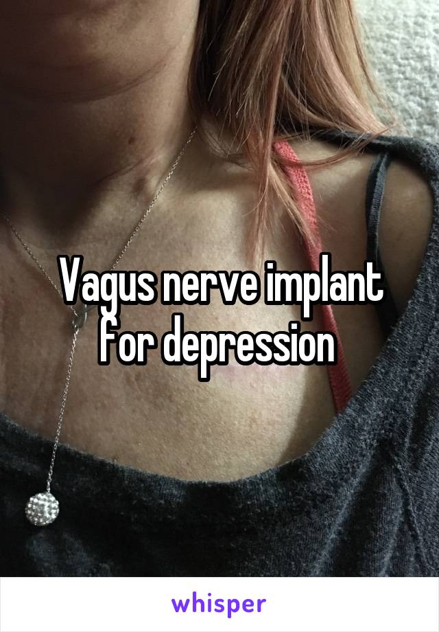 Vagus nerve implant for depression 