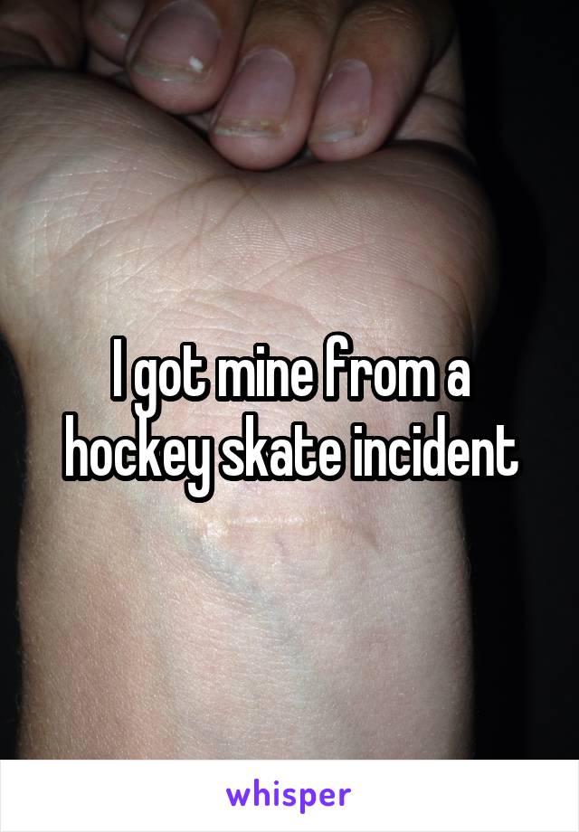 I got mine from a hockey skate incident