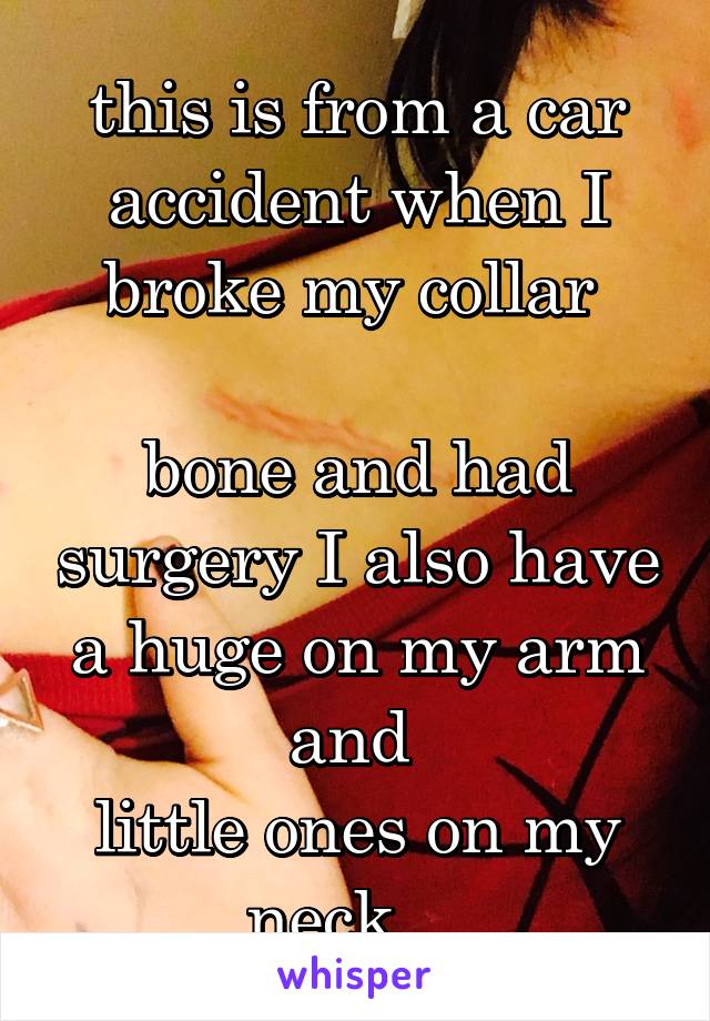 this is from a car accident when I broke my collar 

bone and had surgery I also have a huge on my arm and 
little ones on my neck....