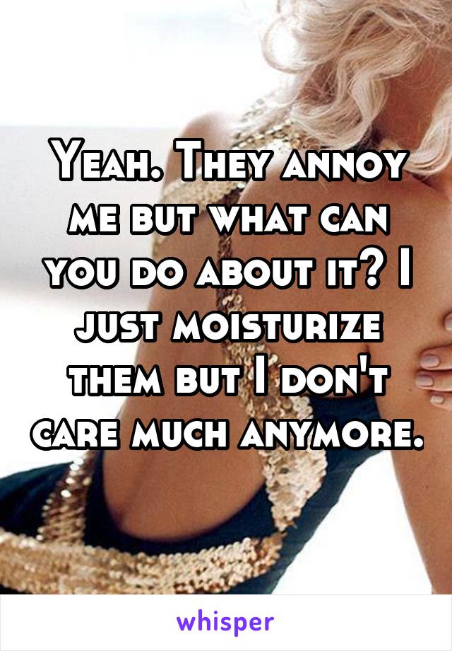 Yeah. They annoy me but what can you do about it? I just moisturize them but I don't care much anymore. 