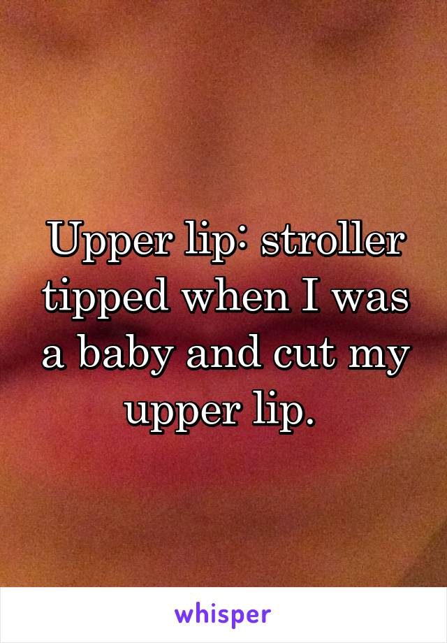 Upper lip: stroller tipped when I was a baby and cut my upper lip. 