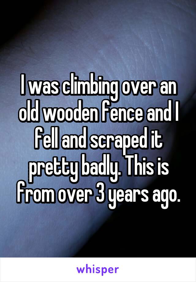 I was climbing over an old wooden fence and I fell and scraped it pretty badly. This is from over 3 years ago.