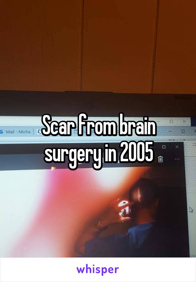 Scar from brain surgery in 2005