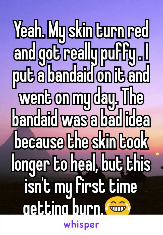 Yeah. My skin turn red and got really puffy . I put a bandaid on it and went on my day. The bandaid was a bad idea because the skin took longer to heal, but this isn't my first time getting burn.😂?