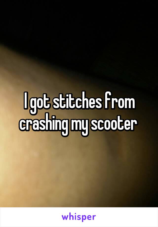 I got stitches from crashing my scooter 