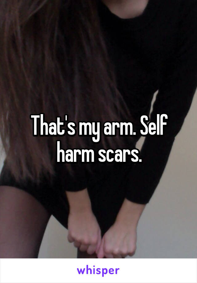 That's my arm. Self harm scars.