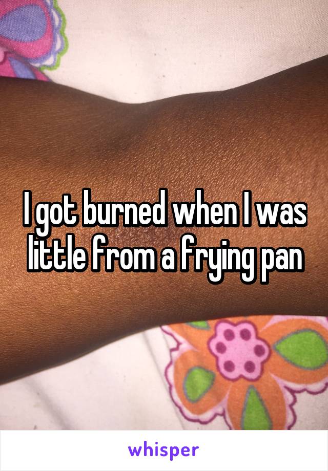 I got burned when I was little from a frying pan