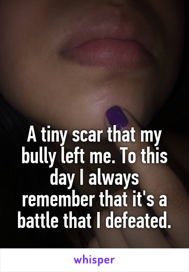 



A tiny scar that my bully left me. To this day I always remember that it's a battle that I defeated.