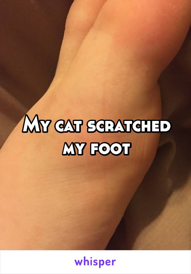 My cat scratched my foot