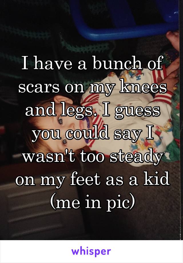 I have a bunch of scars on my knees and legs. I guess you could say I wasn't too steady on my feet as a kid (me in pic)