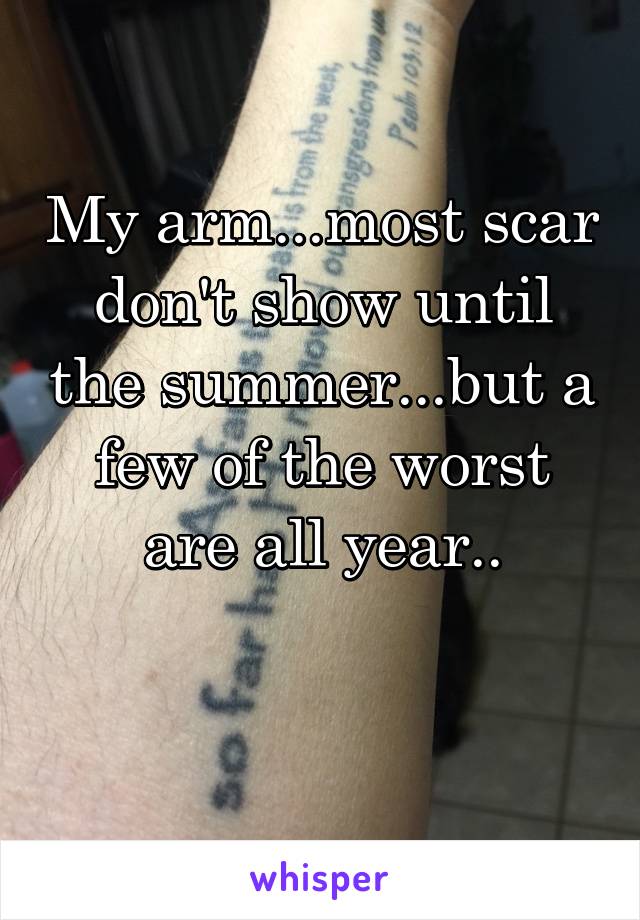 My arm...most scar don't show until the summer...but a few of the worst are all year..

