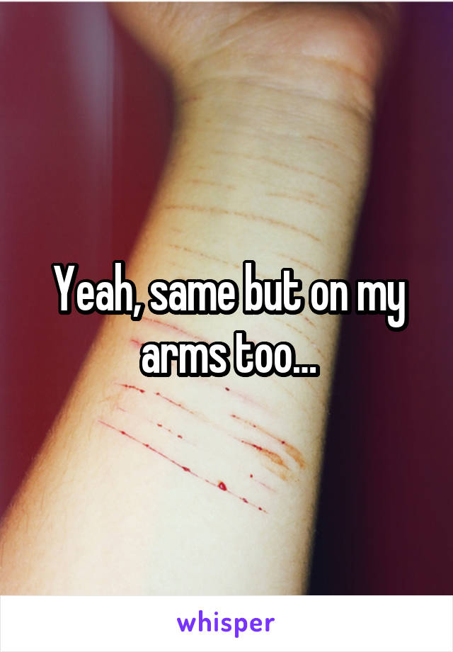 Yeah, same but on my arms too…