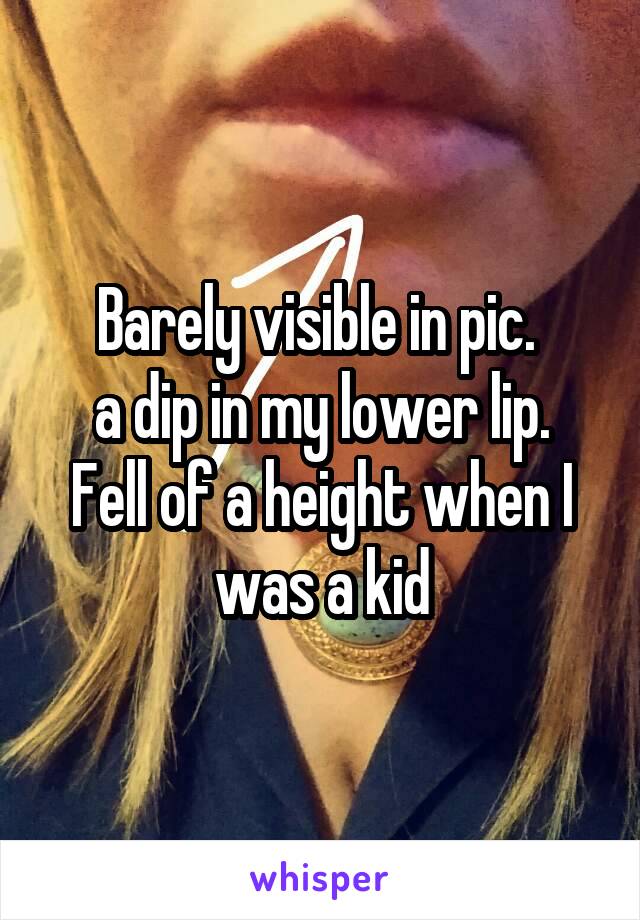 Barely visible in pic. 
a dip in my lower lip.
Fell of a height when I was a kid