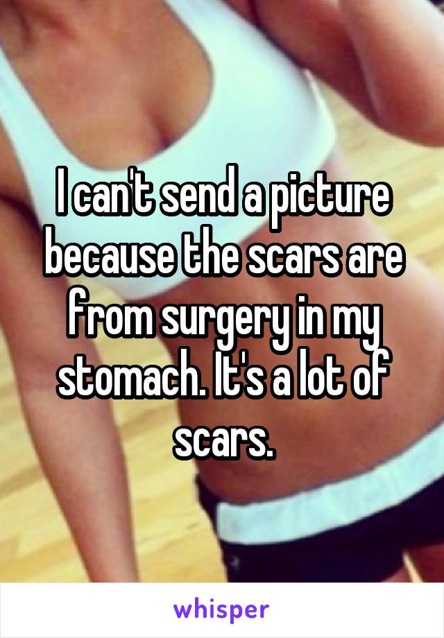 I can't send a picture because the scars are from surgery in my stomach. It's a lot of scars.