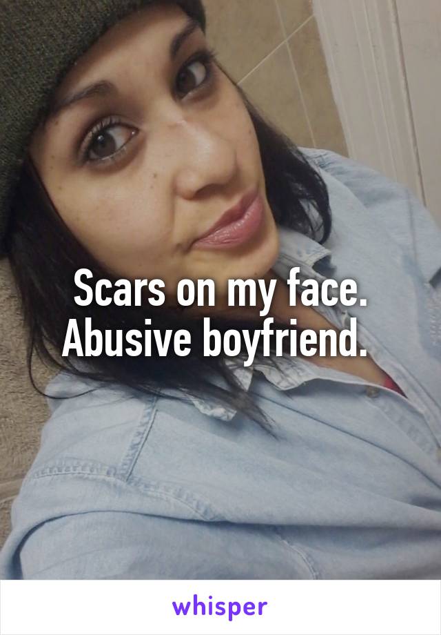 Scars on my face.
Abusive boyfriend. 