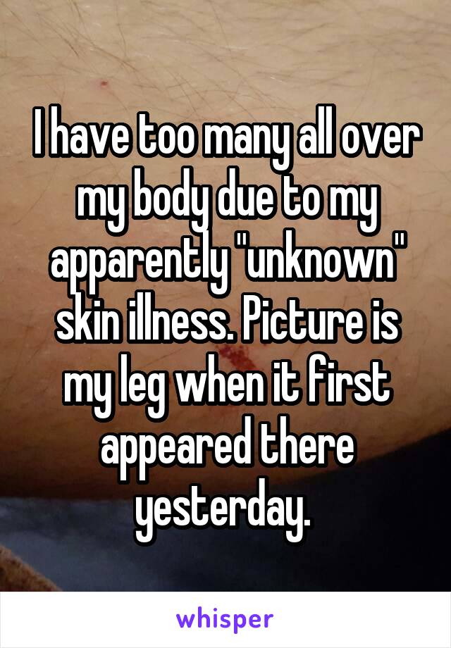 I have too many all over my body due to my apparently "unknown" skin illness. Picture is my leg when it first appeared there yesterday. 