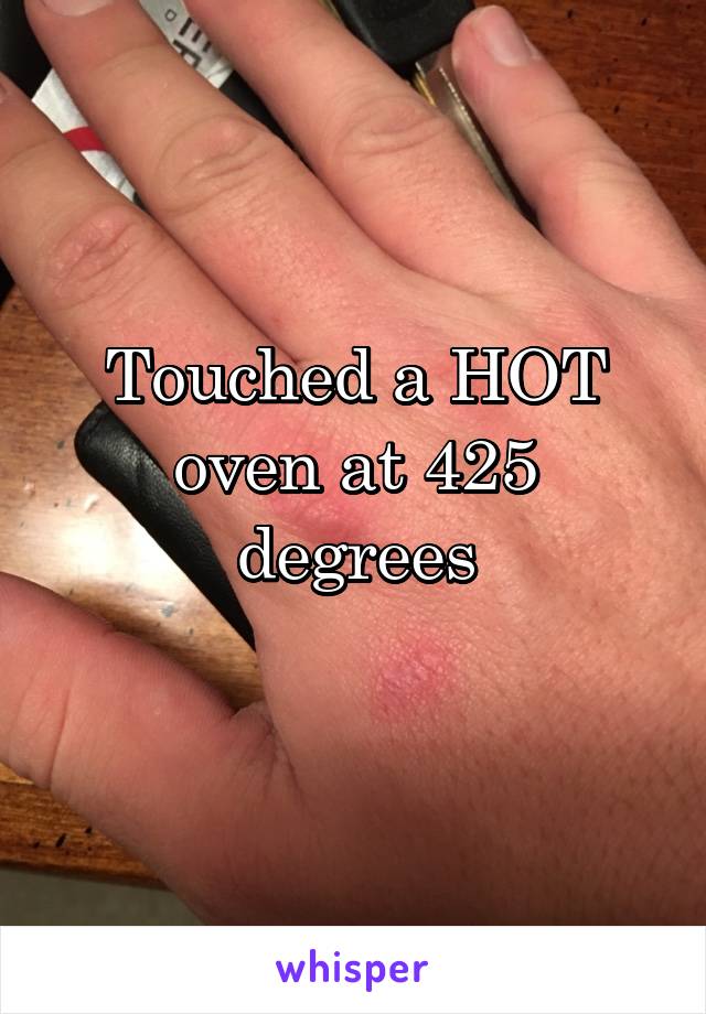 Touched a HOT oven at 425 degrees
