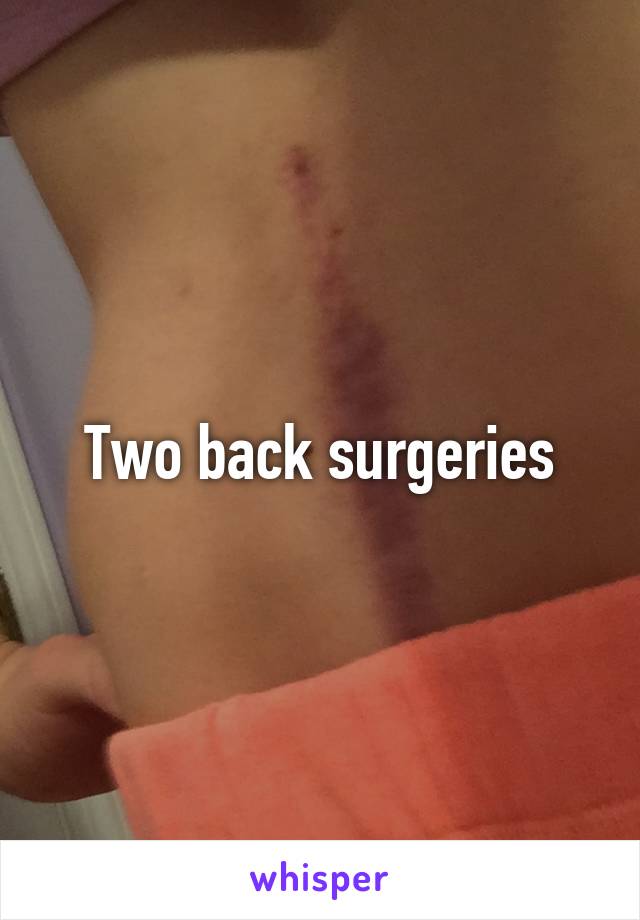 Two back surgeries