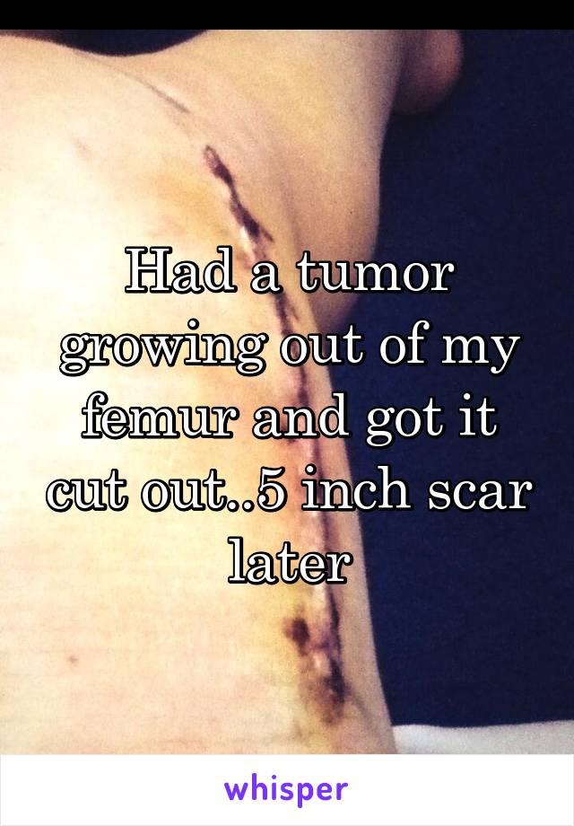 Had a tumor growing out of my femur and got it cut out..5 inch scar later