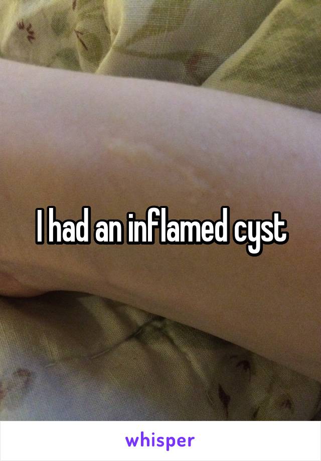 I had an inflamed cyst