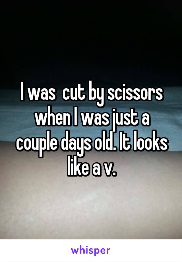 I was  cut by scissors when I was just a couple days old. It looks like a v.