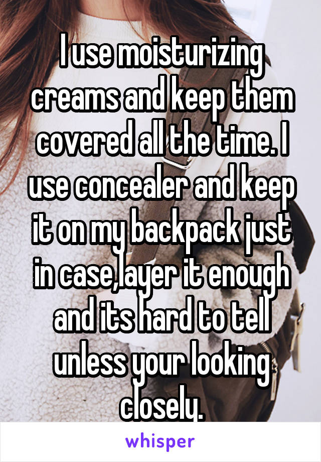 I use moisturizing creams and keep them covered all the time. I use concealer and keep it on my backpack just in case,layer it enough and its hard to tell unless your looking closely.