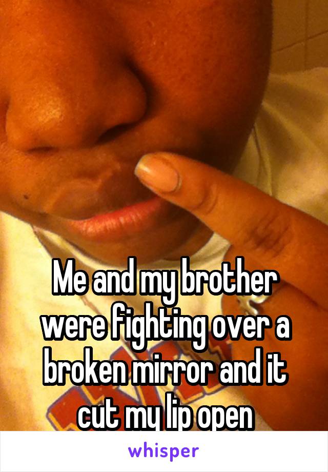                           




Me and my brother were fighting over a broken mirror and it cut my lip open