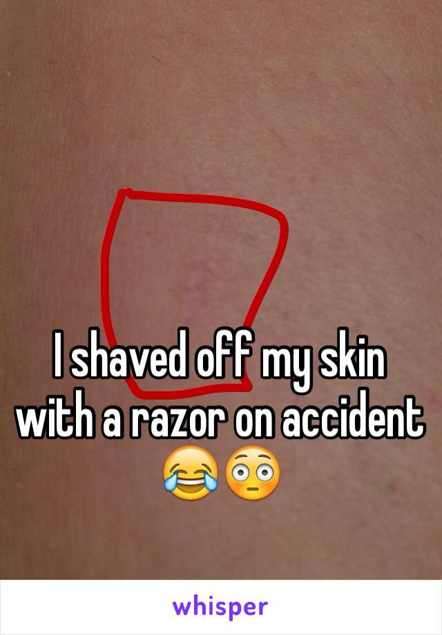 I shaved off my skin with a razor on accident 😂😳