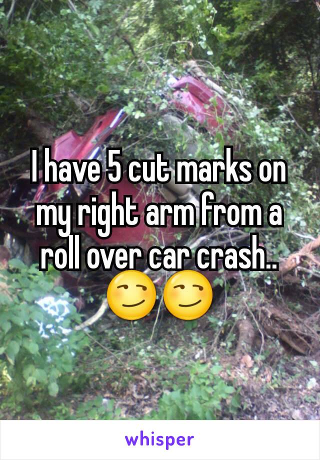 I have 5 cut marks on my right arm from a roll over car crash..😏😏