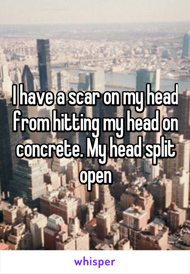 I have a scar on my head from hitting my head on concrete. My head split open