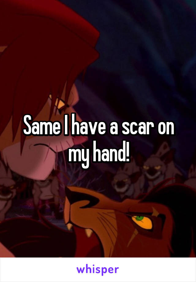 Same I have a scar on my hand!