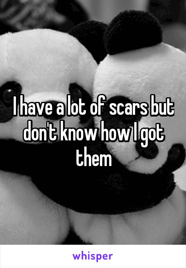 I have a lot of scars but don't know how I got them