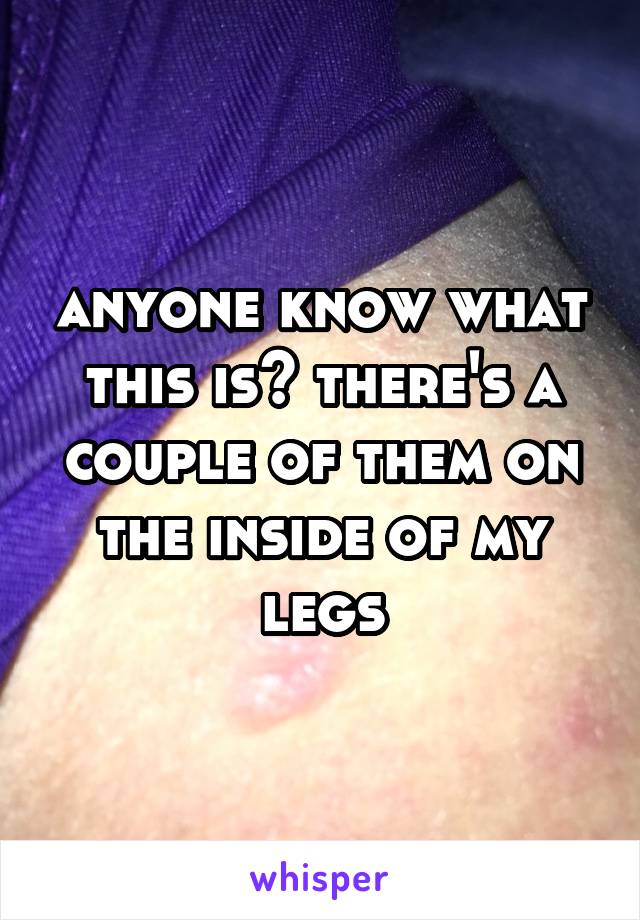 anyone know what this is? there's a couple of them on the inside of my legs