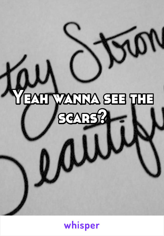 Yeah wanna see the scars?
