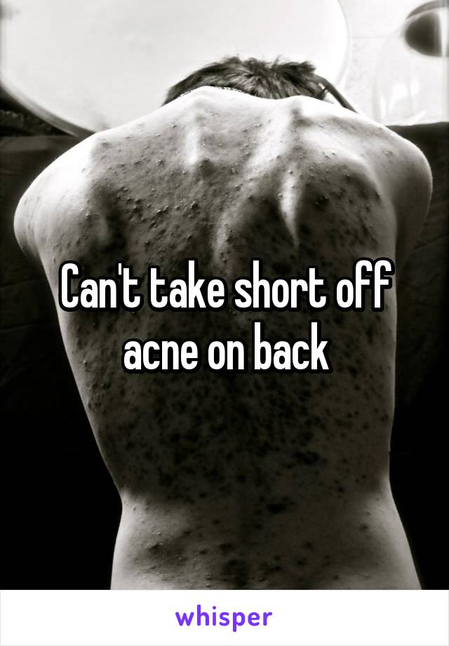 Can't take short off acne on back