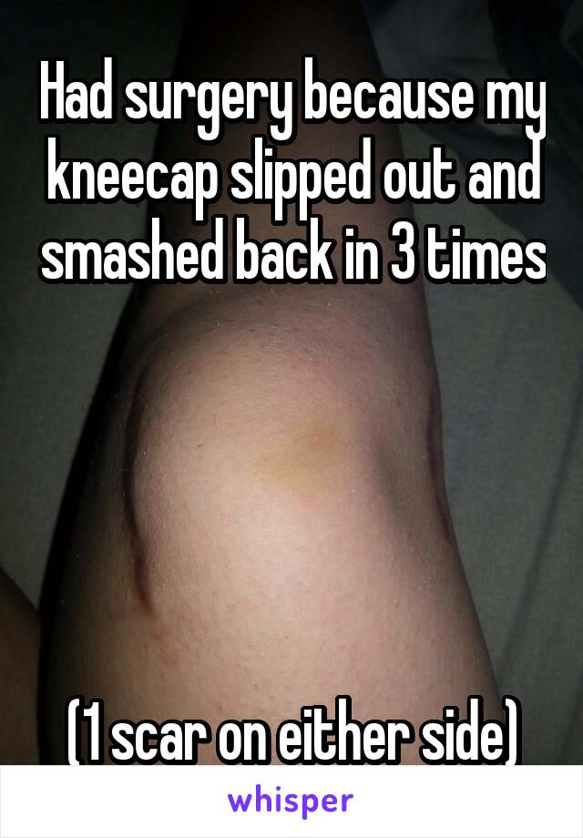 Had surgery because my kneecap slipped out and smashed back in 3 times 




(1 scar on either side)