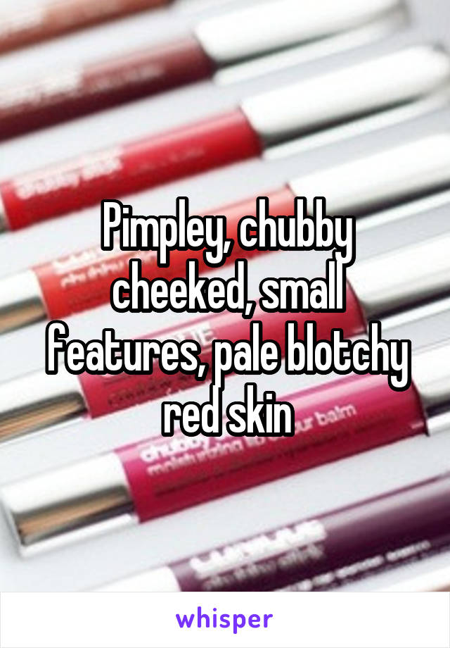 Pimpley, chubby cheeked, small features, pale blotchy red skin