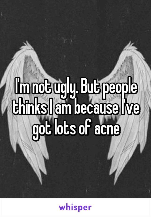 I'm not ugly. But people thinks I am because I've got lots of acne