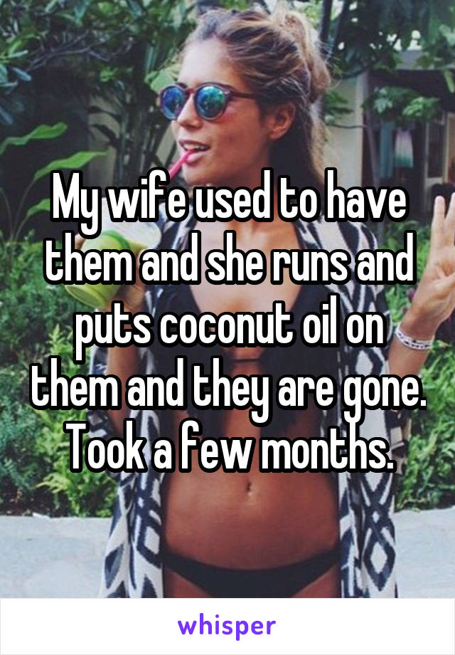 My wife used to have them and she runs and puts coconut oil on them and they are gone.  Took a few months. 